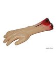 Afhugget arm